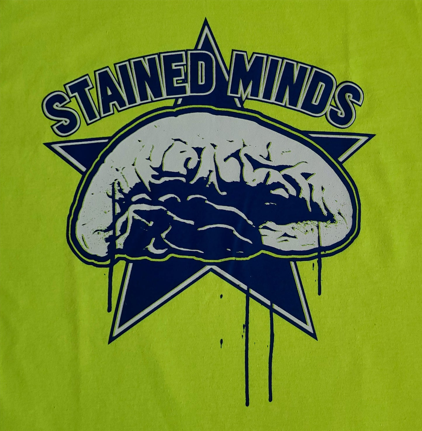 The Stained Brain - Super Sonic Unisex T-Shirt